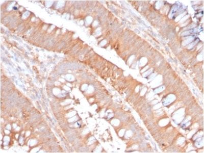 CD59 / Complement Regulatory Protein / Protectin Recombinant Monoclonal Rabbit Antibody (MACIF/2867R)
