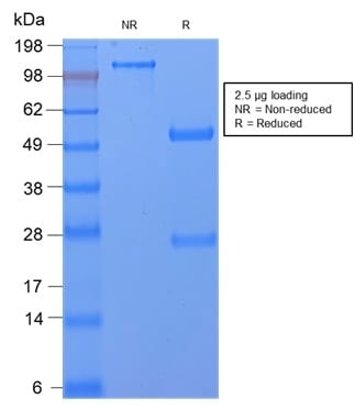CD59 / Complement Regulatory Protein / Protectin Recombinant Monoclonal Rabbit Antibody (MACIF/2867R)