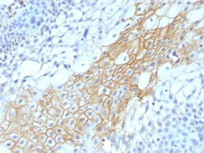 CD59 Monoclonal Mouse Antibody (MACIF/1193)