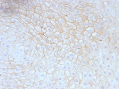 CD59 Monoclonal Mouse Antibody (MACIF/629)