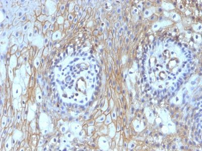 CD59 Monoclonal Mouse Antibody (MACIF/629)