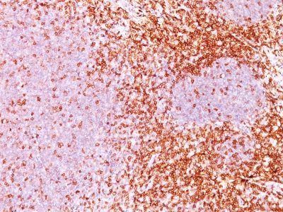 CD6 Monoclonal Mouse Antibody (3F7B5)