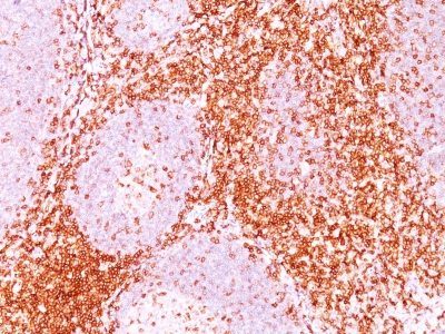 CD6 Monoclonal Mouse Antibody (3F7B5)