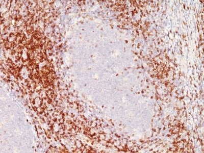 CD6 Monoclonal Mouse Antibody (C6/372 + 3F7B5)
