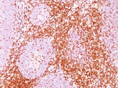 CD6 Monoclonal Mouse Antibody (C6/372)