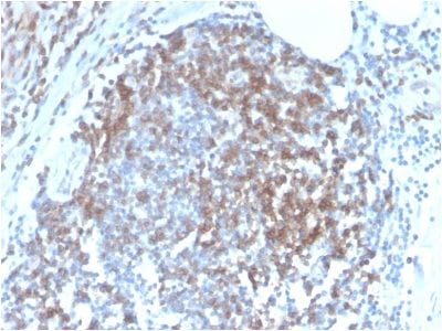 CD6 Recombinant Monoclonal Rabbit Antibody (C6/2884R)