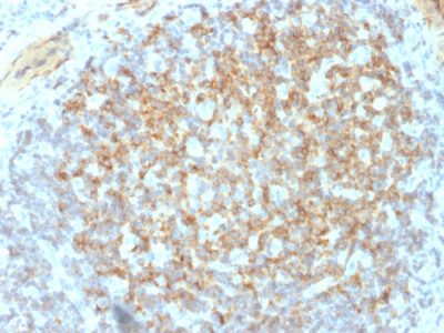 CD61 / Integrin Beta-3 / Platelet-Glycoprotein-IIIa Monoclonal Mouse Antibody (ITGB3/2145)