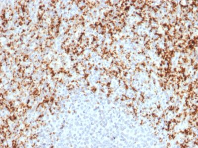 CD61 / Integrin Beta-3 / Platelet-Glycoprotein-IIIa Monoclonal Mouse Antibody (ITGB3/2597)