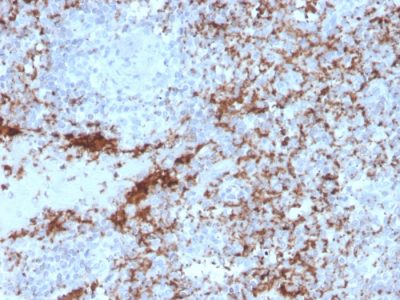 CD61 / Integrin Beta-3 / Platelet-Glycoprotein-IIIa Recombinant Monoclonal Mouse Antibody (rITGB3/2145)