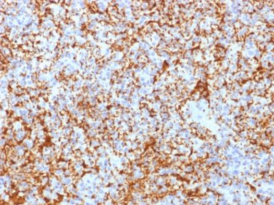 CD61 / Integrin Beta-3 / Platelet-Glycoprotein-IIIa Recombinant Monoclonal Rabbit Antibody (ITGB3/2166R)