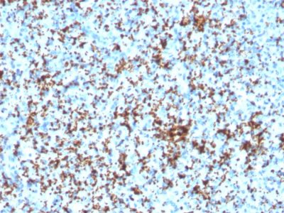 CD61 / Integrin Beta-3 / Platelet-Glycoprotein-IIIa Recombinant Monoclonal Rabbit Antibody (ITGB3/3126R)