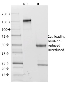 CD62L / L-Selectin Monoclonal Mouse Antibody (CD62L/1588)
