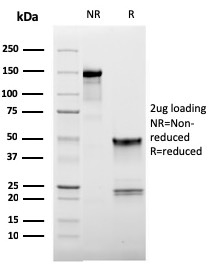 CD62L / L-Selectin Monoclonal Mouse Antibody (LAM1-116)