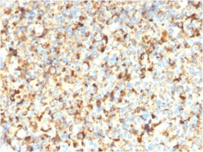 CD63 Recombinant Monoclonal Mouse Antibody (rMX-49.129.5)