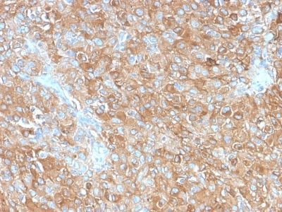CD63 Recombinant Monoclonal Rabbit Antibody (LAMP3/2990R)