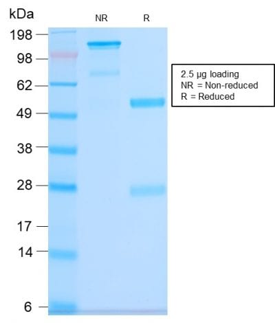 CD63 Recombinant Monoclonal Rabbit Antibody (LAMP3/2990R)