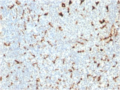 CD68 Monoclonal Mouse Antibody (C68/2511)