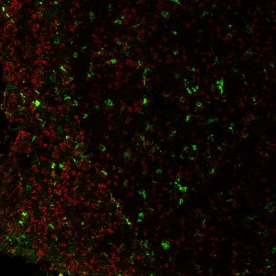 CD68 Monoclonal Mouse Antibody (C68/684 + KP1)