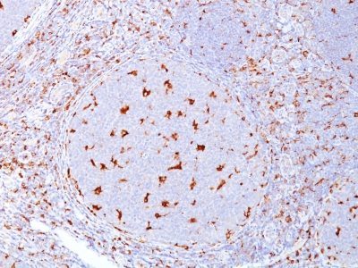 CD68 Monoclonal Mouse Antibody (C68/684)