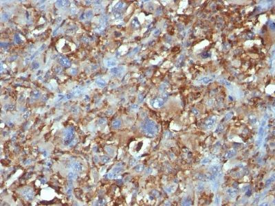 CD68 Monoclonal Mouse Antibody (C68/684)