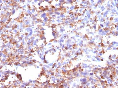 CD68 Monoclonal Mouse Antibody (CD68/G2)