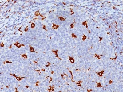 CD68 Monoclonal Mouse Antibody (KP1)