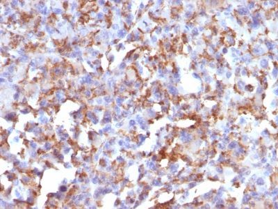 CD68 Monoclonal Mouse Antibody (LAMP4/824)