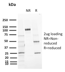 CD72 Monoclonal Mouse Antibody (BU40)