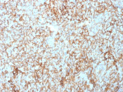 CD73 Monoclonal Mouse Antibody (NT5E/2503)