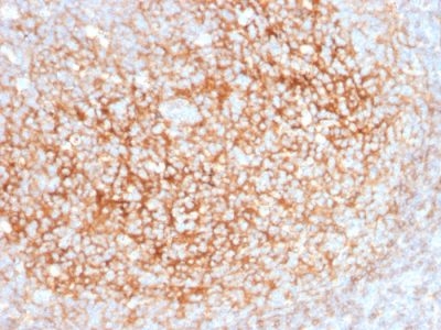 CD73 Monoclonal Mouse Antibody (NT5E/2545)