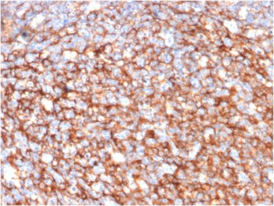 CD73 Monoclonal Mouse Antibody (NT5E/2646)