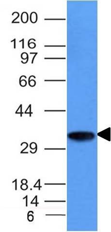 CD74 Monoclonal Mouse Antibody (CLIP/1133)