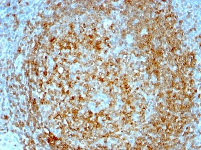 CD74 Monoclonal Mouse Antibody (CLIP/813)