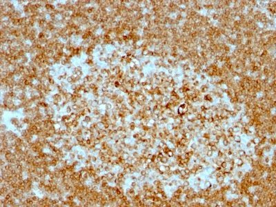 CD74 Monoclonal Mouse Antibody (LN-2 + CLIP/813)
