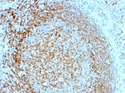 CD74 Monoclonal Mouse Antibody (LN-2)