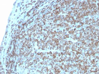 CD74 Recombinant Monoclonal Rabbit Antibody (CLIP/3127R)