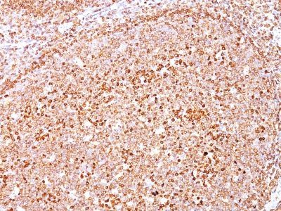 CD79a Monoclonal Mouse Antibody (HM47/A9)