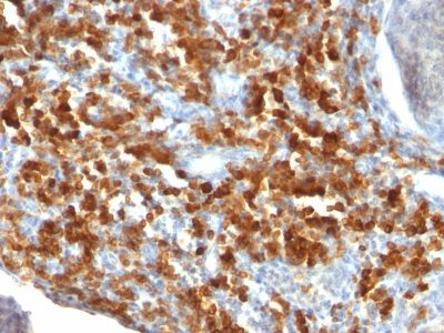 CD79a Monoclonal Mouse Antibody (IGA/515)