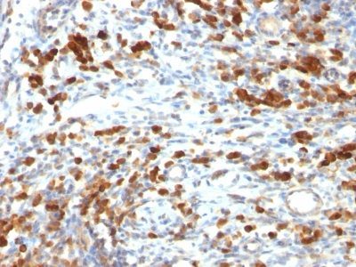 CD79a Monoclonal Mouse Antibody (IGA/764)