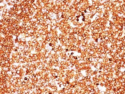 CD79a Monoclonal Mouse Antibody (JCB117 + HM47/A9)