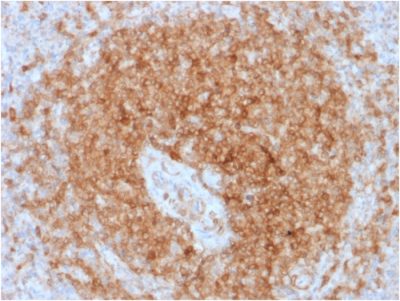 CD79a Recombinant Monoclonal Mouse Antibody (rIGA/764)