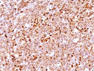 CD79a Recombinant Monoclonal Rabbit Antibody (IGA/1688R)