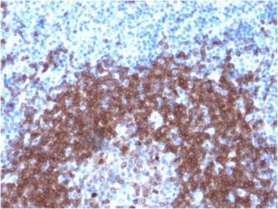 CD79a Recombinant Monoclonal Rabbit Antibody (IGA/1790R)