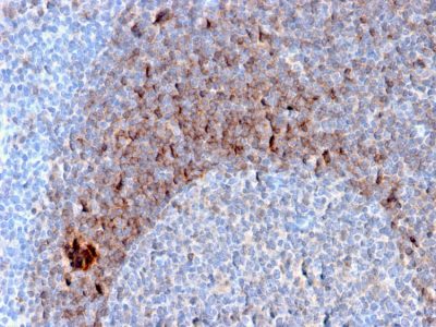 CD79b Monoclonal Mouse Antibody (B29/123)