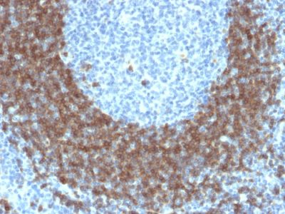 CD79b Monoclonal Mouse Antibody (IGB/1842)