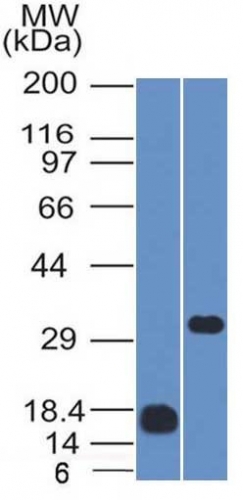 CD79b Monoclonal Mouse Antibody (IGB/1843)
