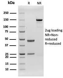 CD79b Recombinant Monoclonal Mouse Antibody (rIGB/1842)