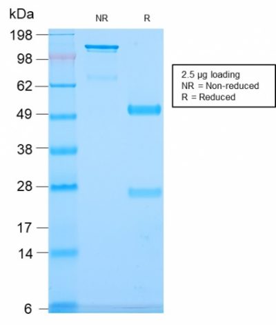 CD79b Recombinant Monoclonal Rabbit Antibody (IGB/2940R)