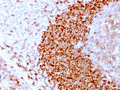 CD79b Recombinant Monoclonal Rabbit Antibody (IGB/3170R)