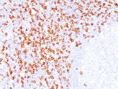 CD8 Monoclonal Mouse Antibody (C8/144B)